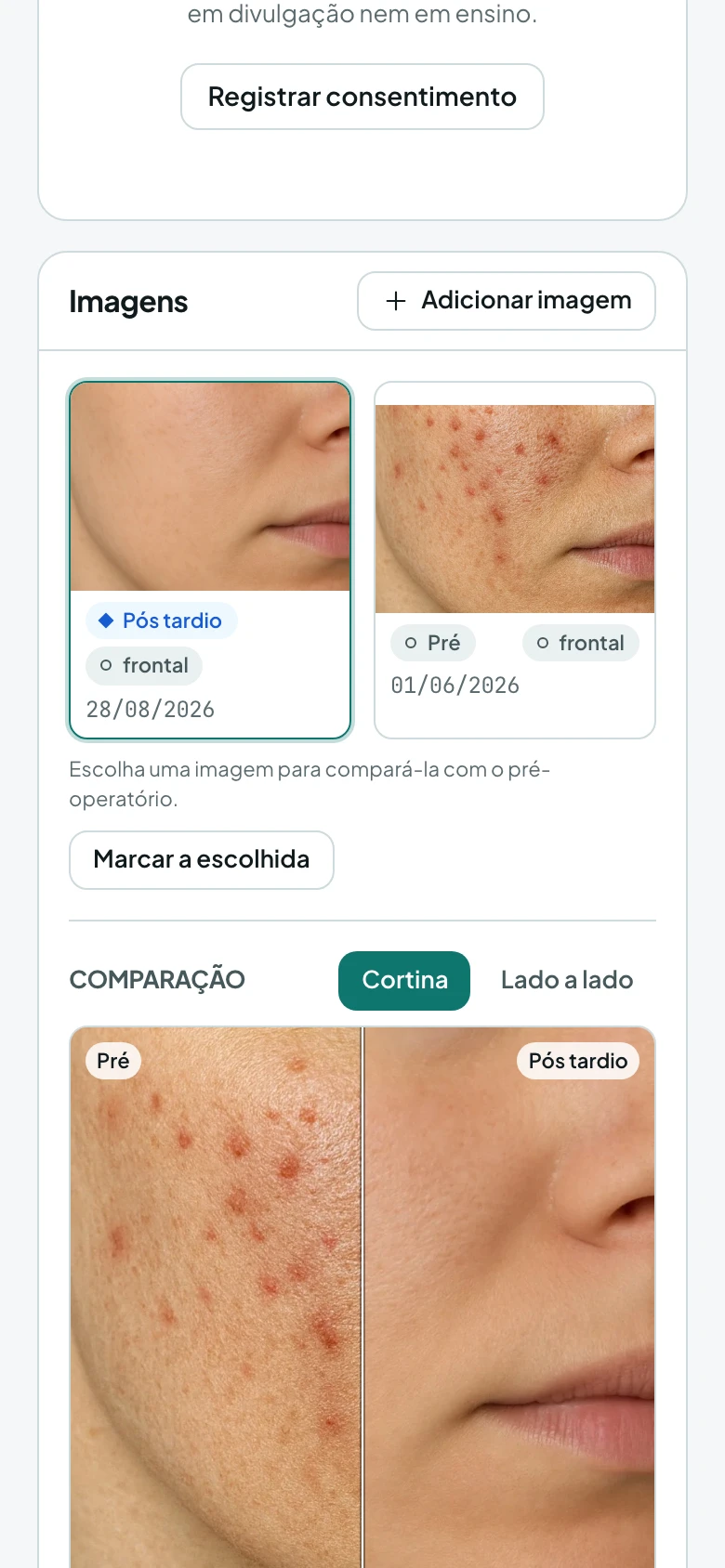 Pré e pós da mesma vista comparados por uma cortina deslizante, com a data de cada um.